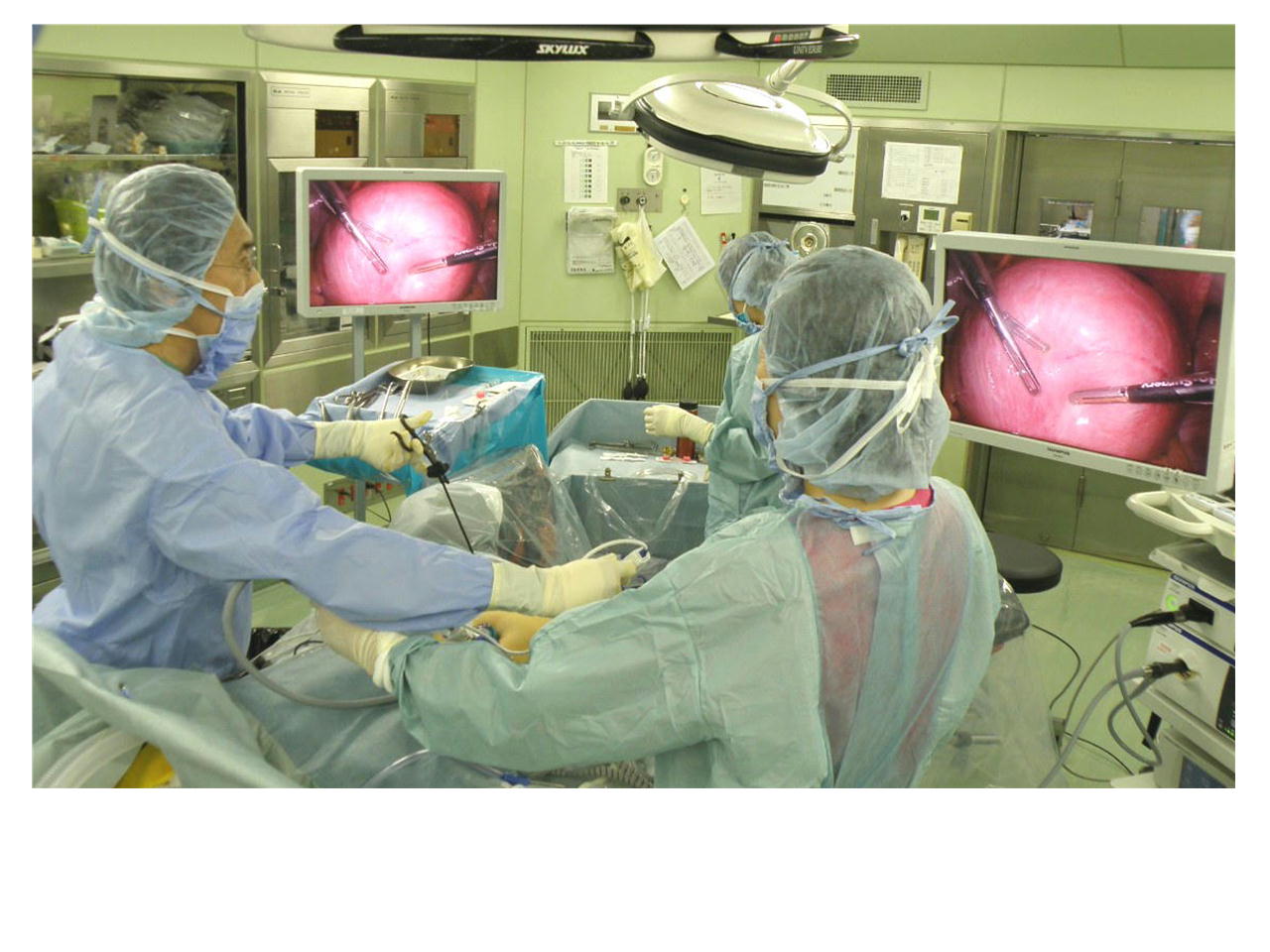 子宮筋腫の腹腔鏡手術風景
